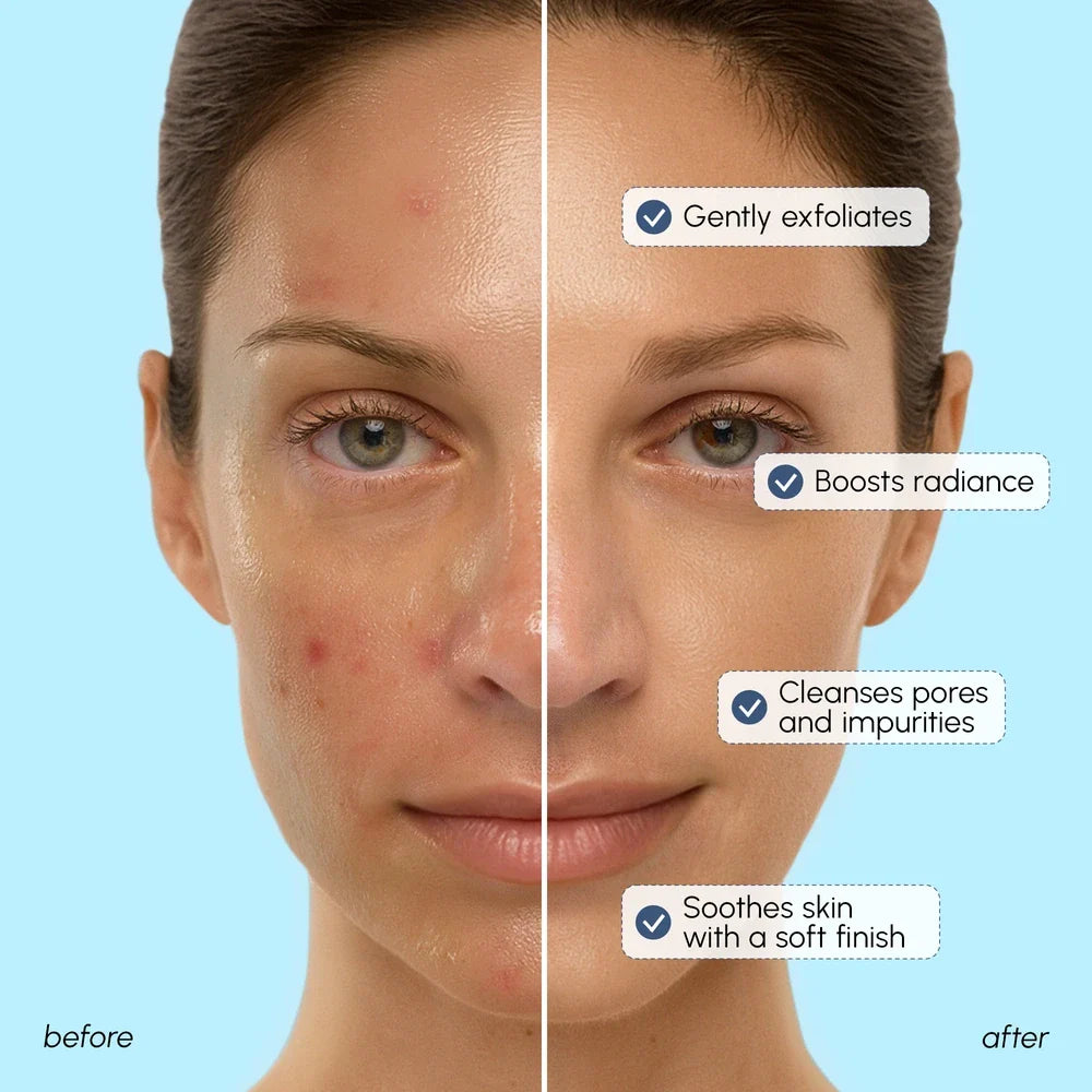 Face Polishing Scrub &amp; Exfoliator